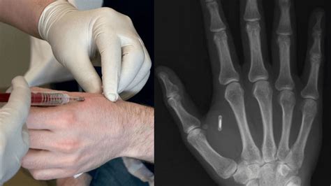 rfid chip 2019|where are rfid chips used.